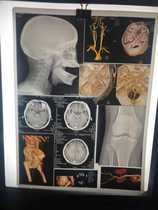 Porcelain white A3 medical color laser inkjet double-sided printing CT 3D reconstruction DR CR X-ray film nuclear magnetism