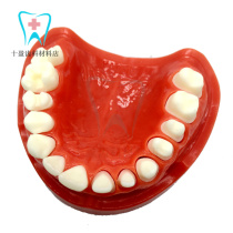 Dentistry Oral Teaching Half-Mouth Baked Porcelain Preparation Model Model Can Replace Dental Dentist Practice