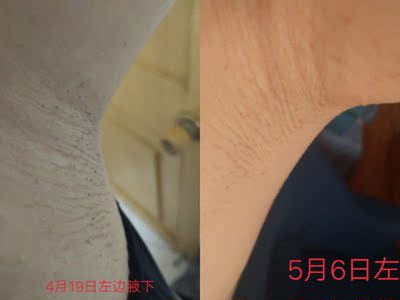 点评绝不偏颇的对比可思美和ulike哪个好，到底哪款真正好用？