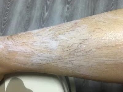 买的时候还在考虑会不会不好用，脱不下来，会不会过敏，报着试试的心态，没想到挺好用的，淡淡的香香的味道，不刺鼻，也没有过敏，没有不舒服，我先试用了腿上的一点，真的脱下来了，没有毛发的地方真干净，下次再试试腋下，会继续使用的，满意。