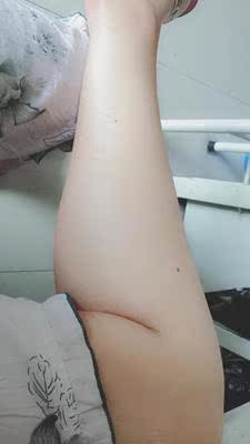 效果很不错，脱的很干净，夏天正好能用上了，我脱毛一次使用就能把毛发不是很多的地方脱得很干净，好喜欢啊，还是第一次买脱毛膏呢，挺划算哦！价格又不贵，份量又足很大一支，之前因为在别家买了，一点效果也没有，而且钱还花的多.还是这次买的脱毛膏好用，脱的很干净还不刺激。很赞！！