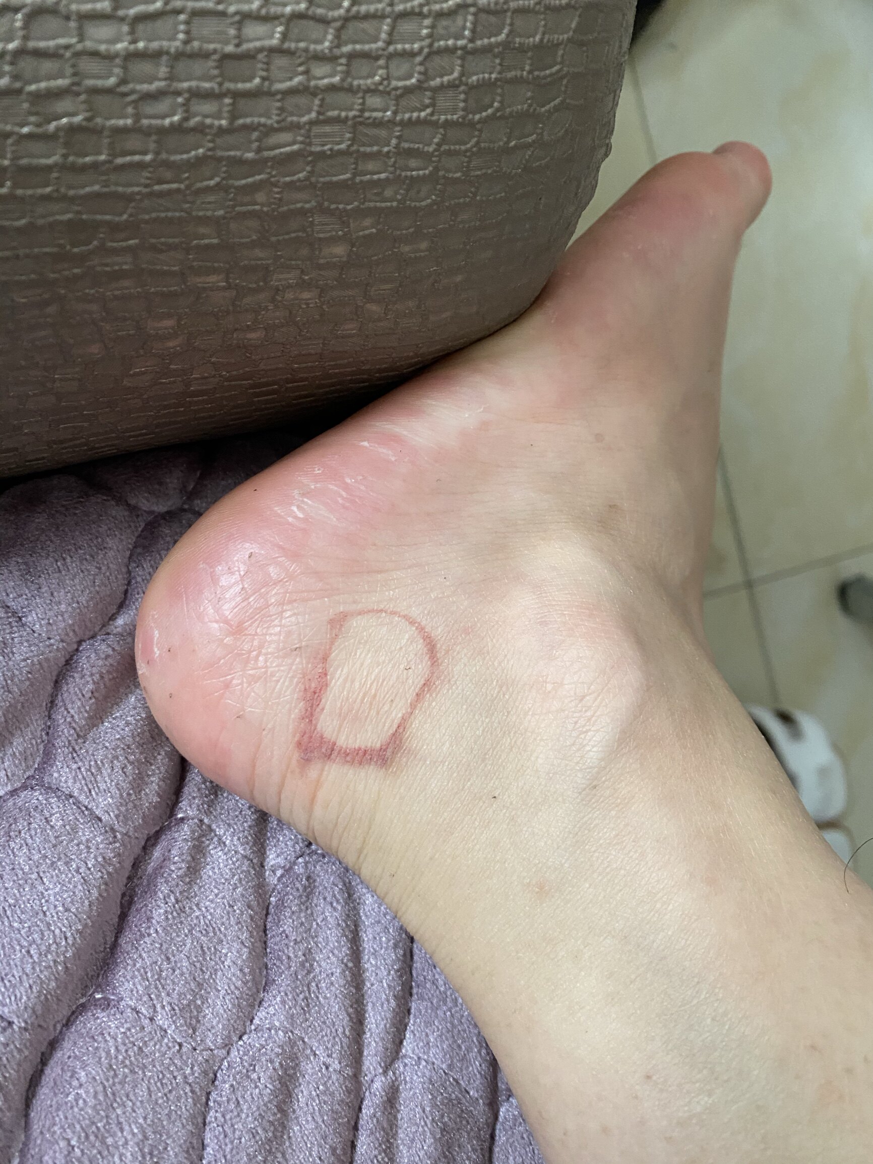 我买了38码数偏硬,我就特意换39码数,以为虽然硬大一码用脚垫就不打脚