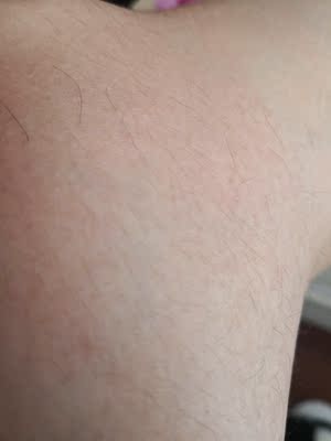 调查心得目前很火的歌岚脱毛仪怎么样,脱毛效果到底好不好?给力