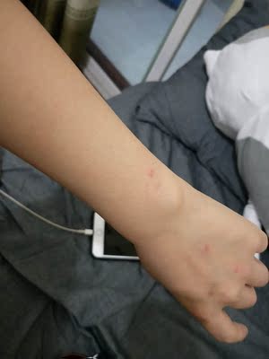 调查心得小仙女点评康佳激光脱毛仪怎么样,是否真的好用?说说吧