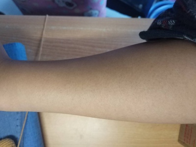 体验夏天爱美用飞利浦SC1999脉冲光脱毛仪怎么样？是忽悠人的吗