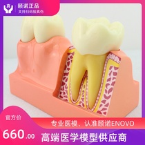ENOVO Yinuo tooth decomposition model Dental anatomy model Stomatology teaching tooth anatomy model