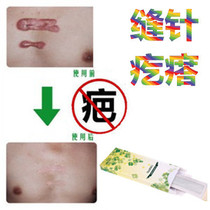 In addition to surgery repair ointment hyperplastic bumps eliminate broken uterine birth Scar Yinling desalination stitch remove pigment