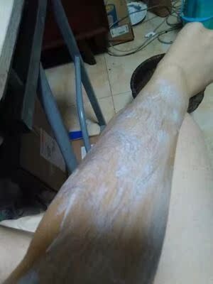 非常好用，脱的很干净，来一个对比图吧，包装很精致，没有损坏。还买一送一，第一印象就非常棒，脱完以后会有一些用小刮板子刮不掉的，但是就用毛巾擦掉就好了。很温和，也不会刺激。味道也还好，挤出来的时候是淡香，用完以后摸那个修复液，身上滑滑的，可以说是非常棒了！