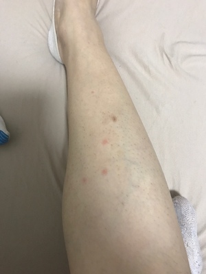 吐槽毛孩子想知道Smoothskin慕金Bare激光脱毛仪怎么样，给力吗？
