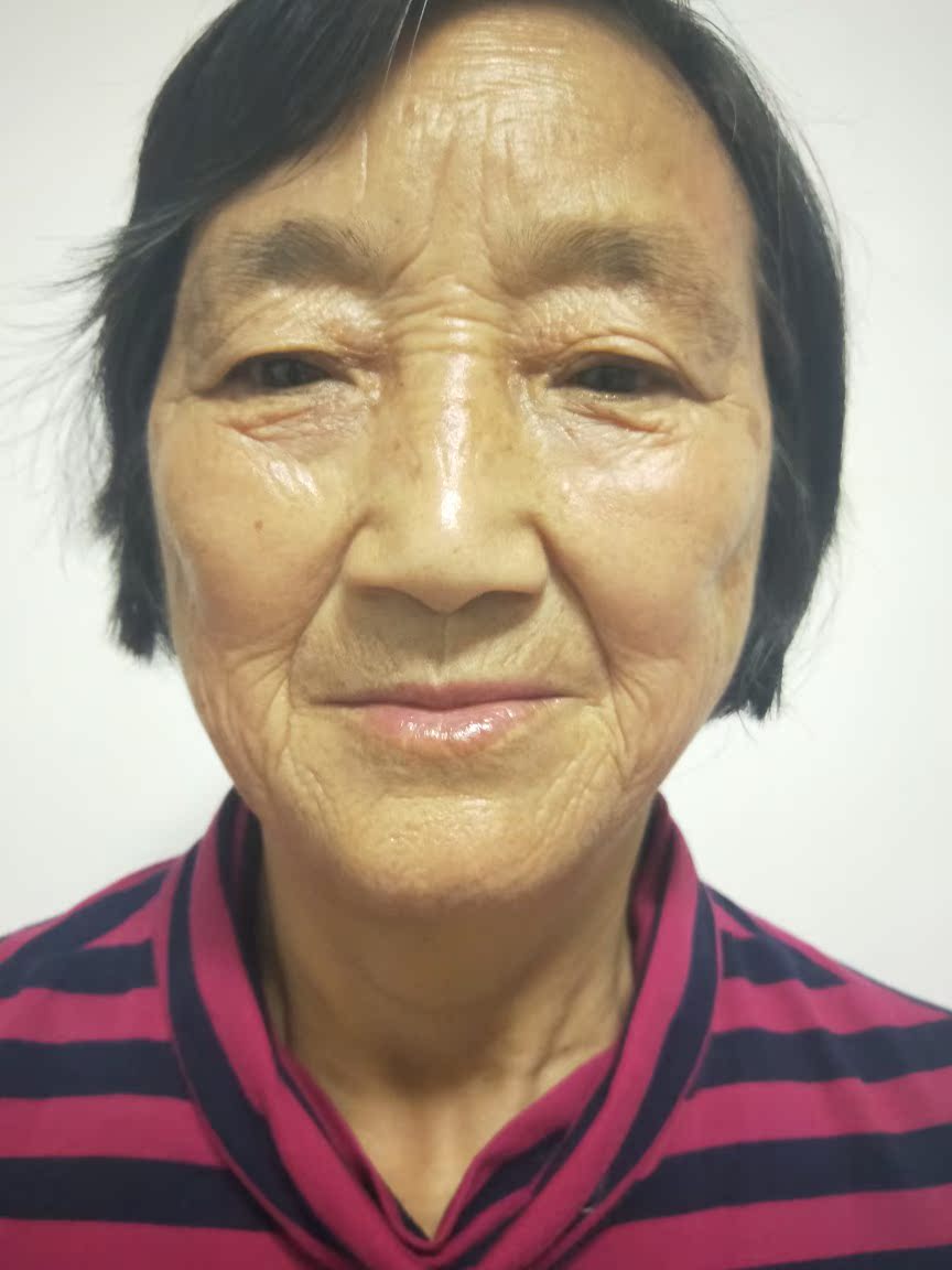 tripollarpink电子美容仪