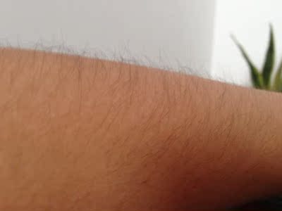 说说真相解说瑞宜激光脱毛仪怎么样，老司机评测是否好用？