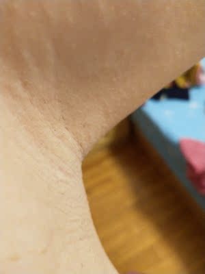 点评绝不偏颇的对比可思美和ulike哪个好，到底哪款真正好用？