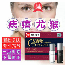 Dot nevus removal face non-mark freckle removal artifact repair cream freckle removal mole liquid home removal black spot nevus