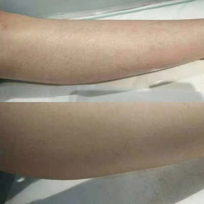 这款喷雾非常干净不留痕迹，用起来也很方便，等几分钟就可以脱了，一点都不费时超级方便的，这个用着也不刺激皮肤不过敏，也不会出现不良的反应，这点非常好，用在腿上的，拿纸巾就可以擦掉，很方便。汗毛脱的很干净的。用过其他家产品，相比之下还是这个好用！用了后腿上的毛全部一下刮干，不痛而且，非常干净不留痕迹。