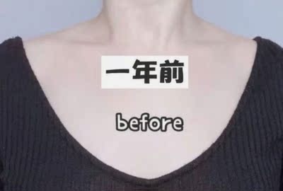 一年前胸是平的可以，用了一年胸现在勉强算是B了吧，是真的慢，这个是真的和体质有关系，我闺蜜用一个月就看到效果了，我用了一个疗程都没感觉，不涨，不热，啥都没有，要不是闺蜜有效果我都坚持不下来。慢就慢吧，有效果就好，继续用。给商家点赞