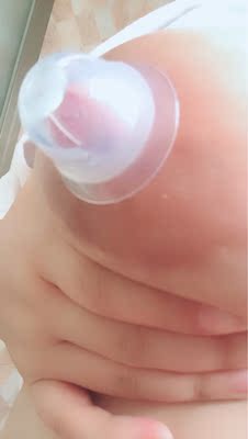 开始吸不住，后面吸住了，又好疼