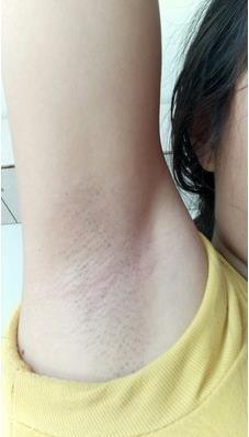 坚持使用了一段时间 效果真的是很好 非常满意