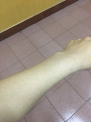 分析就是这款慕金Bare激光脱毛仪怎么样，是否有用？广告勿来！