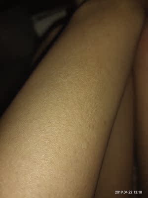 说说真相解说瑞宜激光脱毛仪怎么样，老司机评测是否好用？