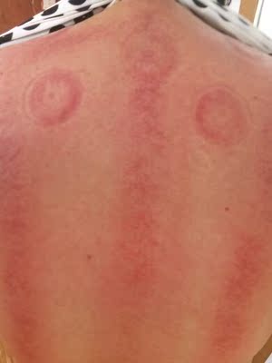 用后评价的，好极了，看图吧，超赞，多档位可调节选适合自己的吧！！！！