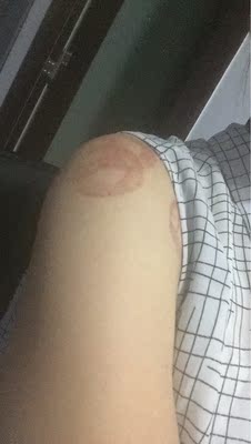 收到后马上试用,棒棒哒🎉肩膀经常酸疼,期待效果。同事看到了,也纷纷要了链接,打算给妈妈也用用看 收到后马上试用,棒棒哒🎉肩膀经常酸疼,期待效果。同事看到了,也纷纷要了链接,打算给妈妈也用用看