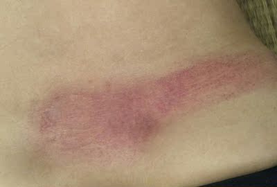 点评非寻按摩器怎么样,真相如何,不看后悔