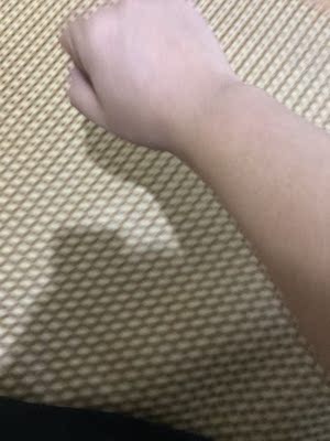 今天第一次用，直接三档有点疼，最后还是坚持下来了，希望能有效果！