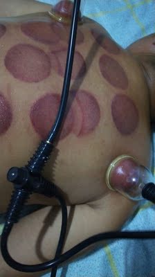 很不错,帮家人做身体,美美哒!自己用着也方便 很不错,帮家人做身体,美美哒!自己用着也方便