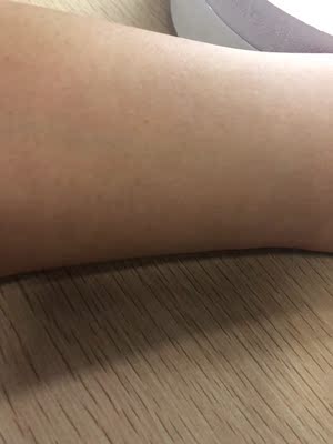 买到现在大约也用了五六天，给手臂做过两次，大约是三天一次，长得挺慢的，到现在为止也只长了两厘米，小腿上的会长得快一点，之前也是种草很久，因为看到评价说机器特别慢，根本没有耐心做下去，一直也挺担心买来没时间用的，现在觉得还好啦，其实没有他们评价的那么慢，我一般没课的时候看电视剧的时候做没觉得不耐烦，还是可以坚持的，希望坚持下去有用，会给大家继续测评的，如果有效果会给小仙女们追加的。