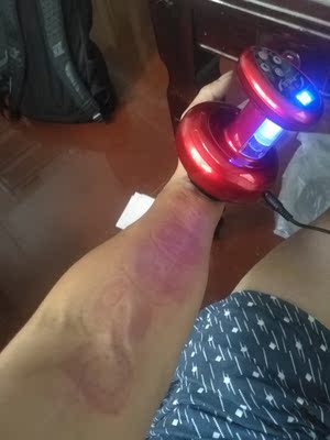 太好了，试了下颈椎病痛好，不痛了，一个人也可操作，超级厉害了，物流也很快，介绍好友来买