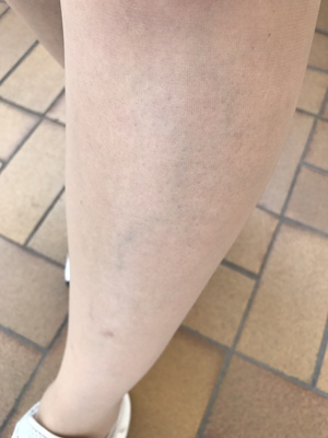 請忽略我的小腿，袜子顏色透明，日光下有亮感，因為經常喝水上廁所頻繁買了開檔款，有點不習慣。平均9元港幣一双如能每双穿上三次就算不得了，穿好再追評