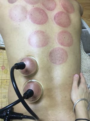 机器很好用,和美容院的效果差不多, 机器很好用,和美容院的效果差不多,