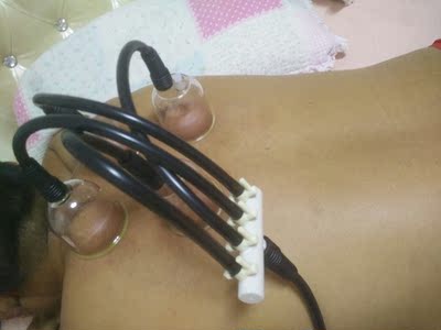 收到后用了几天，劲头挺大，操作简单，配的杯也很厚实，在家自己保养省钱，方便，但愿对我的结节有效果