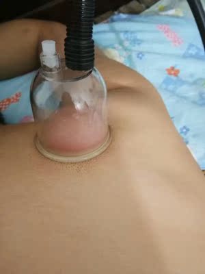 很好用，效果很不错，以后就可以天天拔罐了，省了很多钱，还送了穴位图