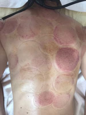 机器很好用,和美容院的效果差不多, 机器很好用,和美容院的效果差不多,