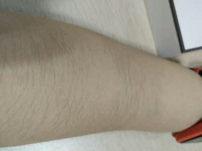 不静音但是这款方便小巧外观漂亮。使用面积比较小但是不会疼。有点费时间但是安全系数满满。电池处非常难开但是紧点才不会轻易进水，98不是充电的有点小贵了但是头部使用的是比较好的材质所以也是物有所值。最后献上我手毛粗壮手也粗壮的手臂给大家看效果！可以看出效果是很显著，除毛很干净！！是值得推荐的好物