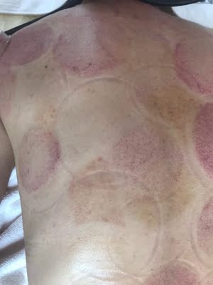 机器很好用,和美容院的效果差不多, 机器很好用,和美容院的效果差不多,