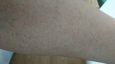 满怀期待买了，两天过去了，跟刀刮过的没什么区别，对皮肤还不好，别再买了。