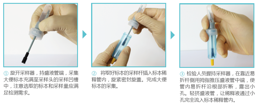 简易操作流程:7 大便标本的预处理在标本稀释管的密闭管腔内进行,与