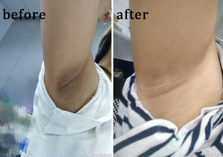 日本pelican美臀皂 臀部去黑色素去角质135g