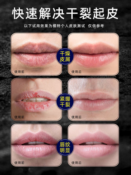 Manshu Leidun Lip Balm 남성용 학생 보습 및 안티 크랙 립밤을위한 특별 립밤 공식 정통 제품 Manshu Leidun Lip Balm 남성용 학생 보습 및 안티 크랙 립밤을위한 특별 립밤 공식 정통 제품