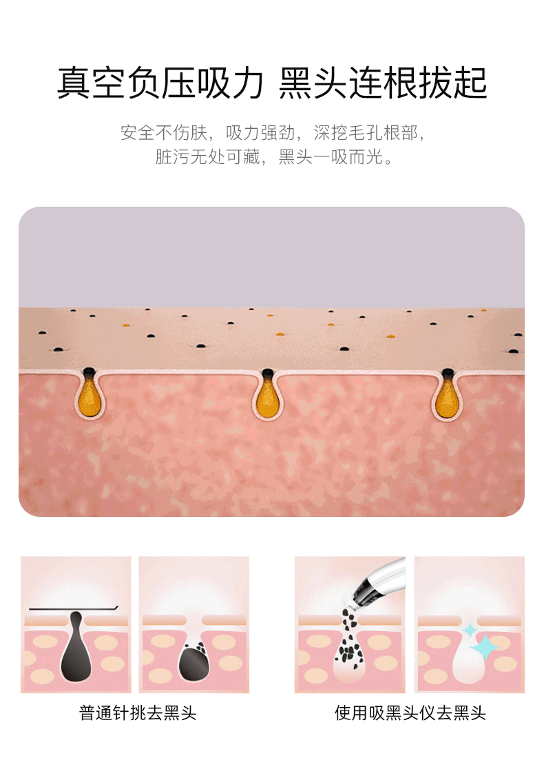 亚马逊热卖吸黑头仪器充电动去黑头神器毛孔清洁器美容仪厂家直销