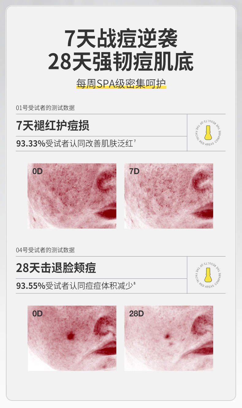【中國直郵】 羽素 祛痘面膜 安修舒緩去閉口粉刺全臉痘補水保濕敏感肌修護面膜 5片/盒