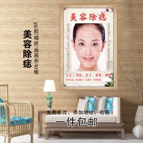 Men and women face point mole removal mole freckle poster face mole face face face mole wall map beauty removal mole Meridian acupoint picture
