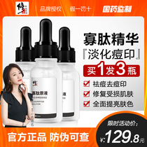 Correction oligopeptide extract Acne lightening acne mark acne scar pit lyophilized powder Essence Male and female students official flagship store