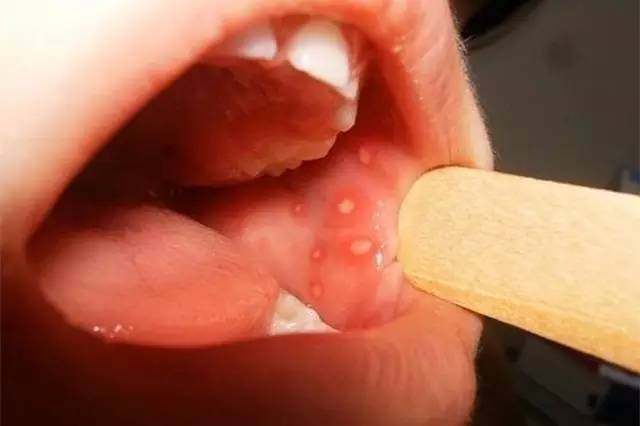 原创丨细心家长必读!让宝宝远离的九大口腔问题