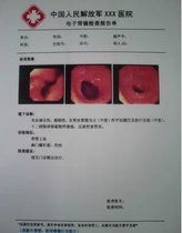 (17 5S) high light porcelain white A4 210 * 297 medical color printing film B supercolor supermedical film