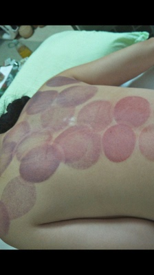 第七代效果很好。吸力特别大。客服特耐心。用于有氧拔罐一吸一放,比传统拔罐舒服。几个朋友试用后都说要跟着买一个自用。 第七代效果很好。吸力特别大。客服特耐心。用于有氧拔罐一吸一放,比传统拔罐舒服。几个朋友试用后都说要跟着买一个自用。