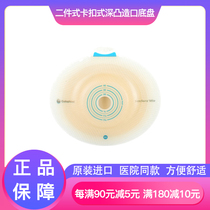 Recreation Warranty Coloplast Winning Mio16961 16971 Two-piece style made pocket micro-convex chassis