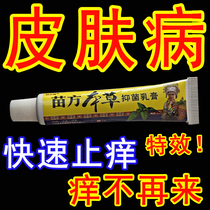 Miao Fang Pteriorum Fresh Silver Special Treatment for Scalp Foot Body Moss Blisters Skin External Tinea Ointment